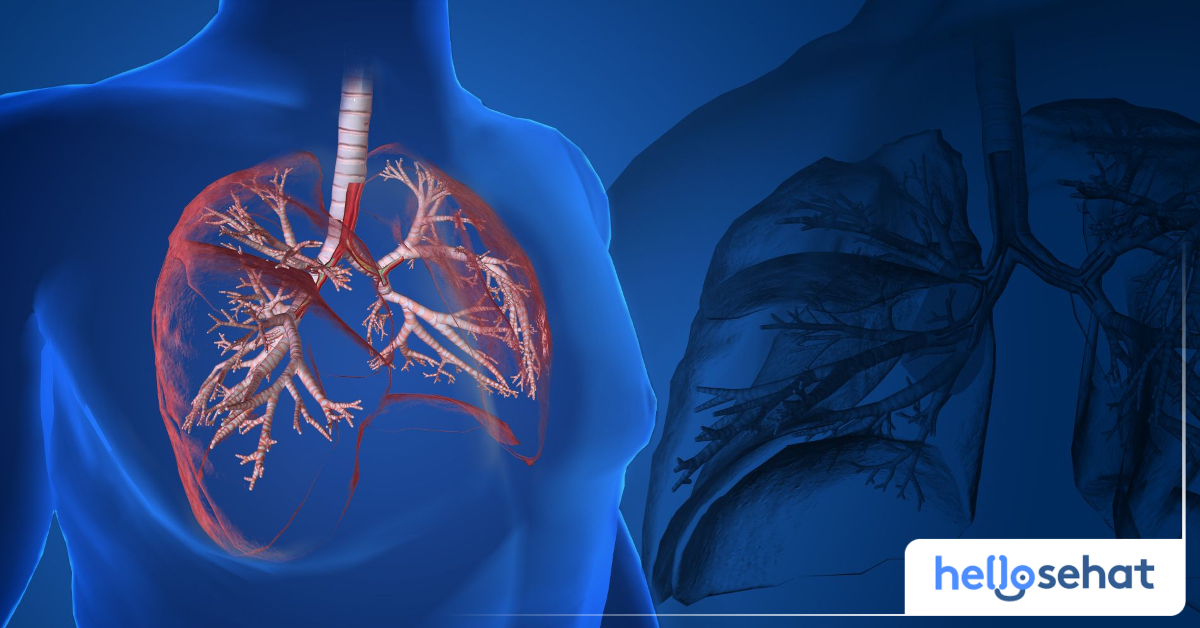 Emfisema: Gejala, Penyebab, Pengobatan, dll. - Hello Sehat